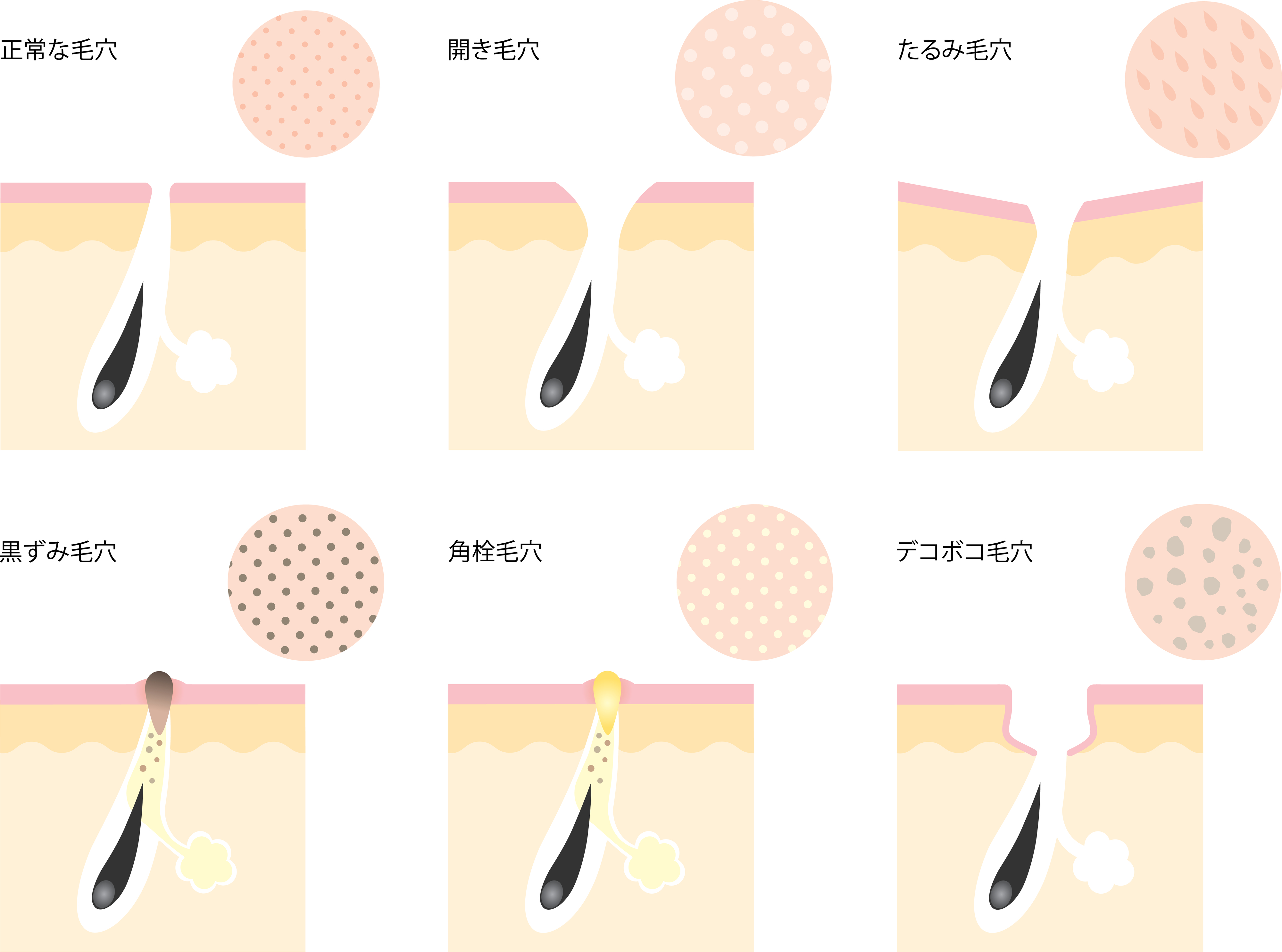 【毛穴トラブルの原因と対策～後編～】毛穴タイプ別ケア方法とは？ 敏感肌・乾燥肌にはAuter